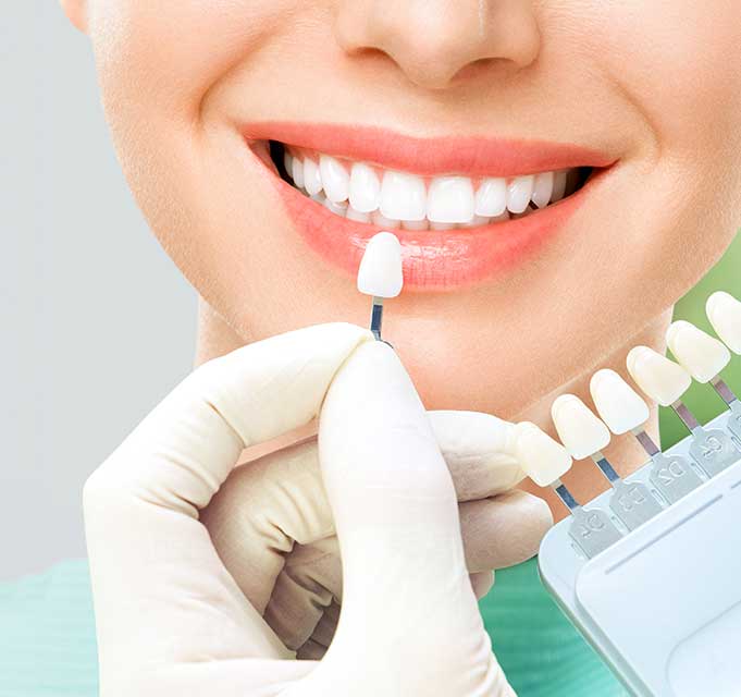 best clear aligner treatment in trivandrum
